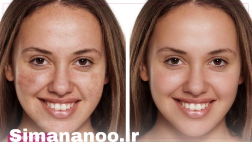 بهترین شوینده صورت ضد لک