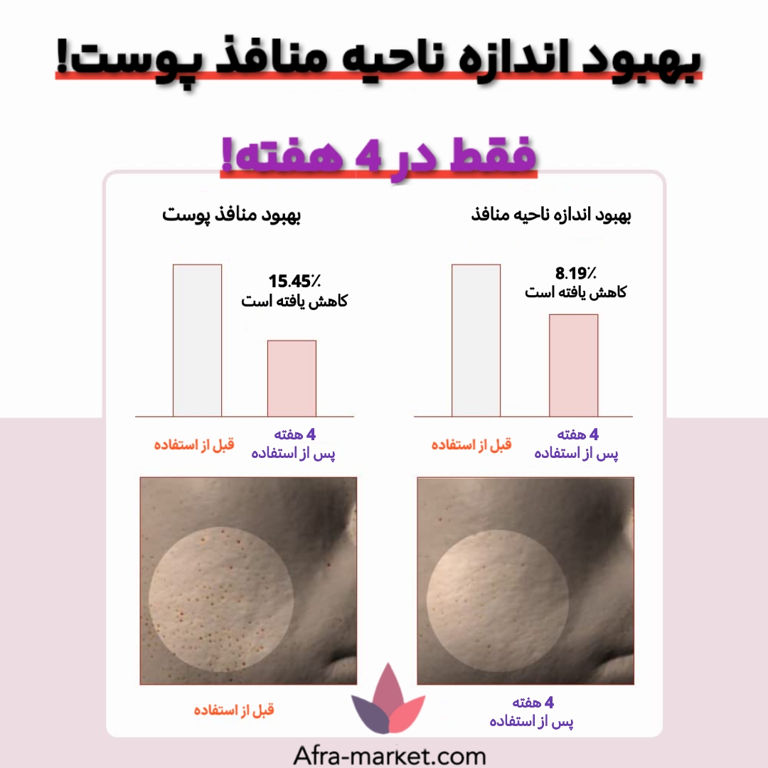 <img src="https://afra-market.com/skin1004-centella-toner" alt="تونر پاککننده منافذ پوست Centella Madagascar، حاوی عصاره سنتلا، مناسب برای پوستهای حساس و مستعد جوش، آرامشبخش و تسکیندهنده پوست، محصول اصل برند Skin1004، خرید از افرا مارکت">