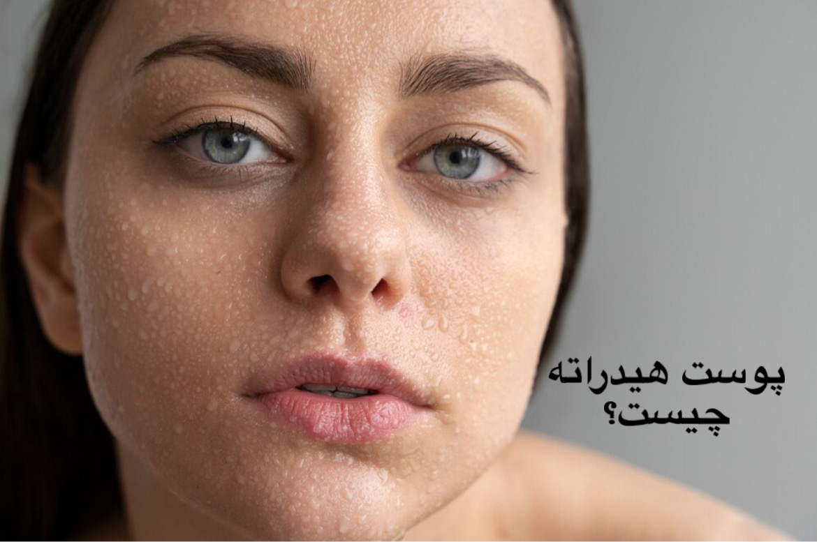 پوست دهیدراته چیست؟ | علائم، تفاوت با پوست خشک و بهترین روش درمان